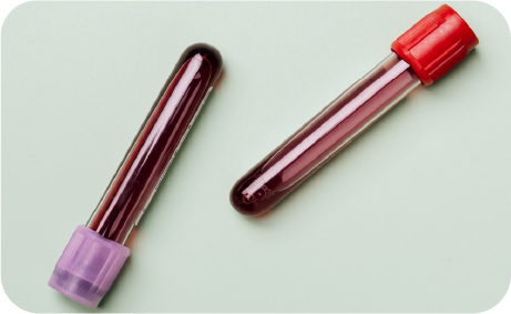 Blood Samples In Test Tubes