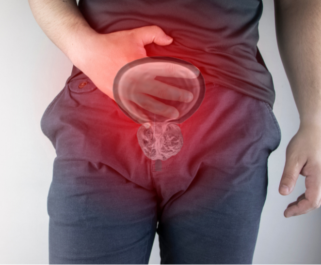 Male Prostate Pain Illustration