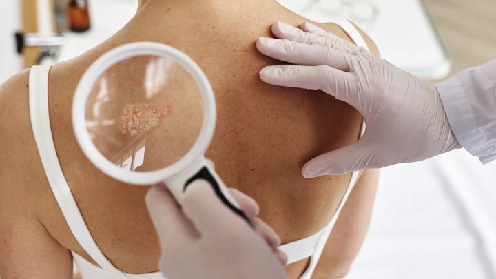 Dermatologist Examining Skin Rash